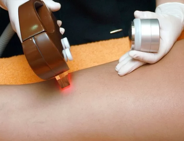 How Can I Get the Best IPL Treatment Near Me Image - How Can I Get the Best IPL Treatment Near Me